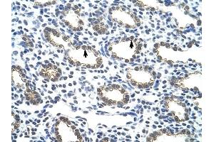 Cytokeratin 18 antibody was used for immunohistochemistry at a concentration of 4-8 ug/ml to stain Alveolar cells (arrows) in Human Lung. (Cytokeratin 18 抗体  (C-Term))