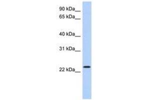 Image no. 1 for anti-Activating Transcription Factor 3 (ATF3) (AA 71-120) antibody (ABIN6740496) (ATF3 抗体  (AA 71-120))