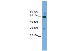 GLIPR1L1 antibody used at 1 ug/ml to detect target protein. (GLIPR1L1 抗体  (Middle Region))