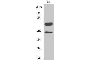 Western Blotting (WB) image for anti-Caspase 8 (CASP8) (Asp384), (cleaved) antibody (ABIN3181767) (Caspase 8 抗体  (Asp384, cleaved))