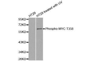 Western blot analysis of extracts from HT29 cells untreated or treated with UV, using phospho-MYC-T358 antibody (ABIN2988193). (c-MYC 抗体  (pThr358))