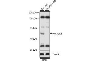 Western blot analysis of extracts from normal (control) and MK4 knockout (KO) HeLa cells, using MK4 antibody (ABIN7268641) at 1:1000 dilution. (MAP2K4 抗体  (AA 300-399))