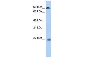 WB Suggested Anti-NFATC1 Antibody Titration:  0. (NFATC1 抗体  (N-Term))