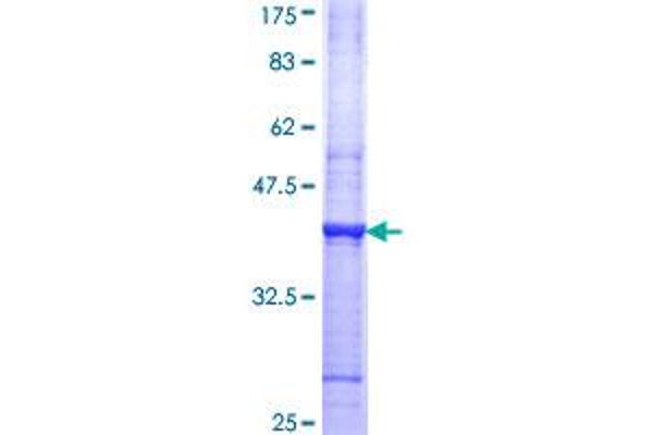 CDK6 Protein (AA 3-99) (GST tag)