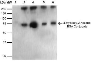 Western Blot analysis of 4-hydroxy-2-hexanal-BSA Conjugate showing detection of 67 kDa 4-hydroxy-2-hexenal-BSA using Mouse Anti-4-hydroxy-2-hexenal Monoclonal Antibody, Clone 6F10 . (4-Hydroxy-2-Hexenal (4-HHE) 抗体 (PE))