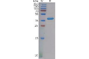 Human C Protein, hFc Tag on SDS-PAGE under reducing condition. (PF4 Protein (AA 32-101) (Fc Tag))