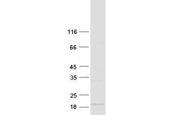 DEXI Protein (Myc-DYKDDDDK Tag)