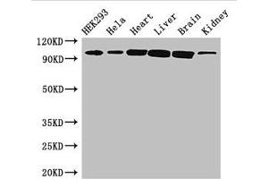 Western Blot Positive WB detected in: HEK293 whole cell lysate, Hela whole cell lysate, Mouse heart tissue, Mouse liver tissue, Mouse brain tissue, Mouse kidney tissue All lanes: CDH2 antibody at 3 μg/mL Secondary Goat polyclonal to rabbit IgG at 1/50000 dilution Predicted band size: 100, 98 kDa Observed band size: 100 kDa (N-Cadherin 抗体  (AA 746-906))