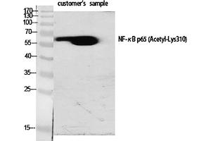 Western Blot analysis of various cells using Acetyl-NFκB-p65 (K310) Polyclonal Antibody diluted at 1:1000. (NF-kB p65 抗体  (acLys310))