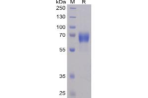 Human NTB-A Protein, mFc-His Tag on SDS-PAGE under reducing condition. (SLAMF6 Protein (AA 22-226) (mFc-His Tag))