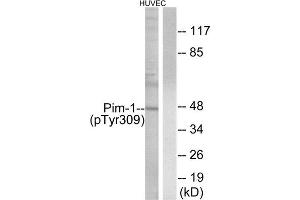 Western Blotting (WB) image for anti-Pim-1 Oncogene (PIM1) (pTyr309) antibody (ABIN1847325) (PIM1 抗体  (pTyr309))