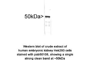 Image no. 1 for anti-Vimentin (VIM) antibody (ABIN363417) (Vimentin 抗体)