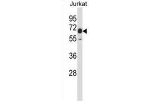 Western Blotting (WB) image for anti-PX domain-containing protein kinase-like protein (PXK) antibody (ABIN2997775) (PXK 抗体)