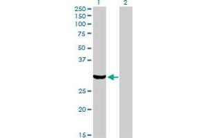 Western Blotting (WB) image for anti-Protein Kinase, Interferon-Inducible Double Stranded RNA Dependent Activator (PRKRA) (AA 1-313) antibody (ABIN563706)