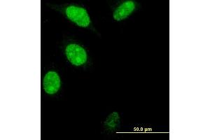 Immunofluorescence of monoclonal antibody to FOXM1 on HeLa cell. (FOXM1 抗体  (AA 22-110))