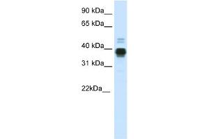 WB Suggested Anti-HOXA11 Antibody Titration:  0. (Homeobox A11 抗体  (C-Term))