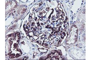 Immunohistochemical staining of paraffin-embedded Human Kidney tissue using anti-SCHIP1 mouse monoclonal antibody. (SCHIP1 抗体)