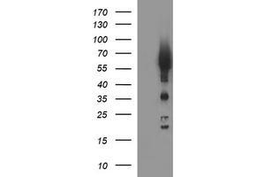 Image no. 1 for anti-Tyrosine Hydroxylase (TH) antibody (ABIN1501367) (Tyrosine Hydroxylase 抗体)