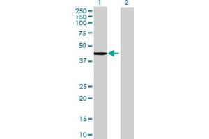 Western Blotting (WB) image for TDO2 293T Cell Transient Overexpression Lysate(Denatured) (ABIN1333687)