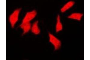 Immunofluorescent analysis of CSN1 staining in SKOV3 cells. (GPS1 抗体)