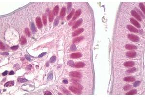 Anti-MSK1 antibody IHC staining of human small intestine. (MSK1 抗体  (AA 331-380))