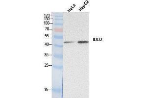 Western Blotting (WB) image for anti-Indoleamine 2,3-Dioxygenase 2 (IDO2) (Internal Region) antibody (ABIN6280734) (IDO2 抗体  (Internal Region))