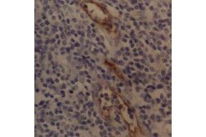 Immunohistochemistry (IHC) image for anti-Selectin P (Granule Membrane Protein 140kDa, Antigen CD62) (SELP) antibody (ABIN2472250) (P-Selectin 抗体)