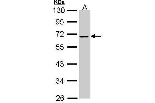 alpha 2 Antiplasmin 抗体  (Center)