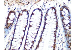 Immunohistochemistry of paraffin-embedded human colon using PP1 beta Rabbit mAb (ABIN1679819, ABIN3018859, ABIN3018860 and ABIN7101675) at dilution of 1:100 (40x lens). (PPP1CB 抗体)