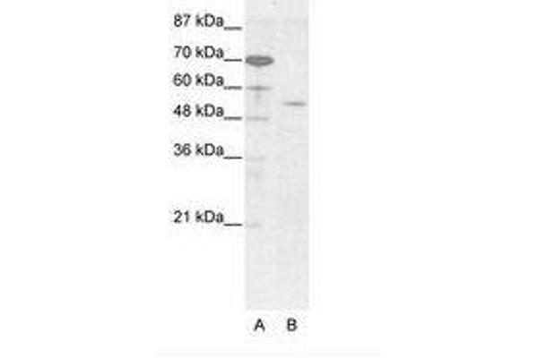 EVX2 抗体  (AA 63-112)