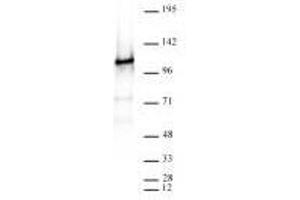 Western Blotting (WB) image for anti-CCCTC-Binding Factor (Zinc Finger Protein) (CTCF) antibody (ABIN6731034)