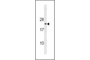 Mouse p27Kip1 Antibody (C-term ) (ABIN1881618 and ABIN2843237) western blot analysis in mouse heart tissue lysates (35 μg/lane). (CDKN1B 抗体  (C-Term))