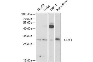 Western blot analysis of extracts of various cell lines, using CDK1 antibody (ABIN6134274, ABIN6138303, ABIN6138304 and ABIN6219543) at 1:1000 dilution. (CDK1 抗体  (AA 208-258))