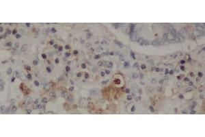Immunohistochemistry of paraffin-embedded Rat lung using CD68 Polyclonal Antibody at dilution of 1:50 (CD68 抗体)