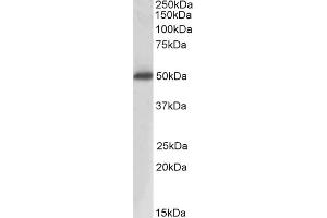 Western Blotting (WB) image for anti-Acid Phosphatase, Prostate (ACPP) antibody (ABIN5855941) (ACPP 抗体)