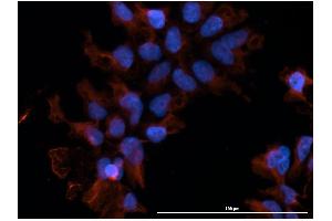 Immunofluorescence  staining of huSSECTM cell line overexpressing hFcRn-EGFP using  clone DVN24 at 15µg/ml and Texas Red™ conjugated anti-mouse secondary. (FcRn 抗体)