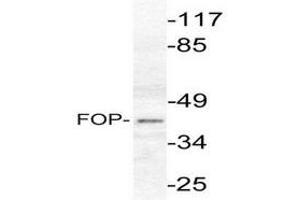 Image no. 1 for anti-FGFR1 Oncogene Partner (FGFR1OP) antibody (ABIN265416) (FGFR1OP 抗体)