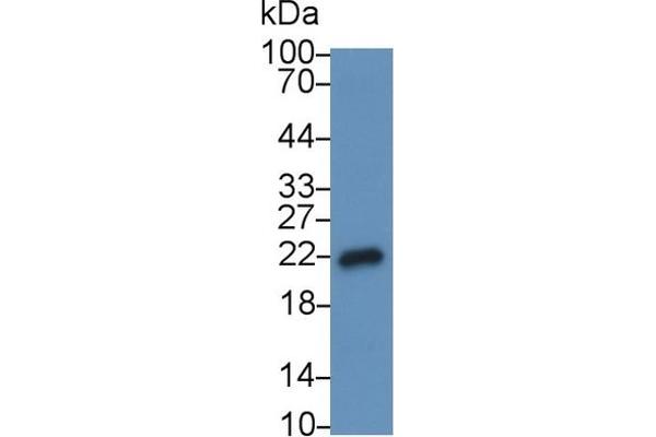 IL-18 抗体  (AA 37-193)