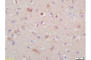 Formalin-fixed and paraffin embedded rat brain labeled with Anti- TSHR(NT) Polyclonal Antibody, Unconjugated (ABIN723470) at 1:200 followed by conjugation to the secondary antibody and DAB staining (TSH receptor 抗体  (AA 31-100))