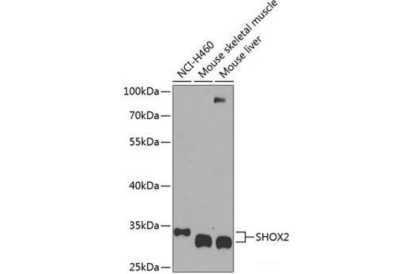SHOX2 抗体