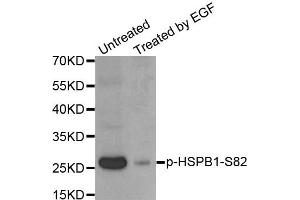 Western Blotting (WB) image for anti-Heat Shock 27kDa Protein 1 (HSPB1) (pSer82) antibody (ABIN1870246) (HSP27 抗体  (pSer82))