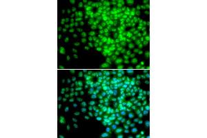 Immunofluorescence analysis of HeLa cells using POLR2F antibody. (POLR2F 抗体)