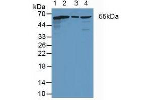 Western blot analysis of (1) Human HeLa cells, (2) Rat Heart Tissue, (3) Rat Intestine Tissue and (4) Rat Brain Tissue. (Coxsackie Adenovirus Receptor 抗体  (AA 20-229))