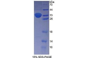 SDS-PAGE analysis of Human PENK Protein. (Enkephalin 蛋白)