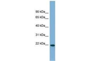 Image no. 1 for anti-Fibronectin Type III Domain Containing 4 (FNDC4) (AA 71-120) antibody (ABIN6742082) (FNDC4 抗体  (AA 71-120))