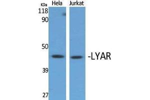 Western Blotting (WB) image for anti-Ly1 Antibody Reactive (LYAR) (Internal Region) antibody (ABIN3185425) (LYAR 抗体  (Internal Region))