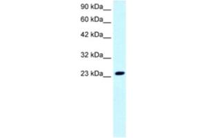 Western Blotting (WB) image for anti-FLJ11730 antibody (ABIN2460699) (FLJ11730 抗体)