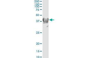 Western Blotting (WB) image for anti-Crystallin, mu (CRYM) (AA 215-314) antibody (ABIN560481)