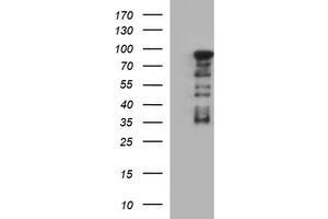 Image no. 1 for anti-Forkhead Box P1 (FOXP1) antibody (ABIN1498299) (FOXP1 抗体)