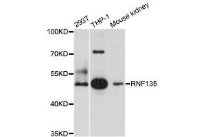 Western blot analysis of extracts of various cell lines, using RNF135 antibody (ABIN5996007) at 1/1000 dilution. (RNF135 抗体)